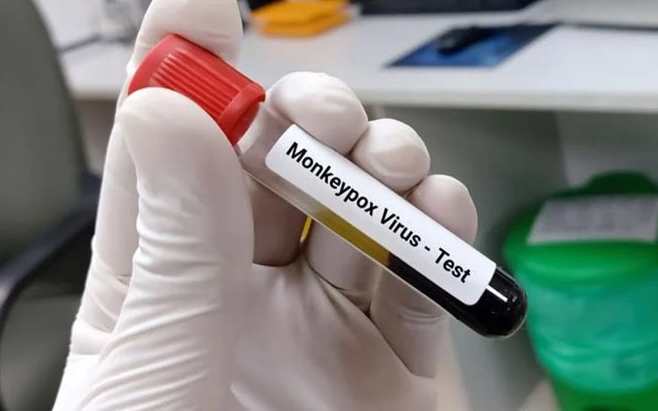 في ظل تفشي جدري القرود… أهم ما يجب عليك معرفته عن هذا المرض